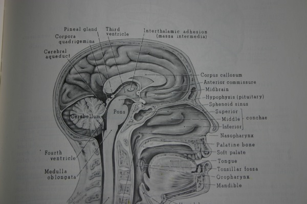 Brain337140